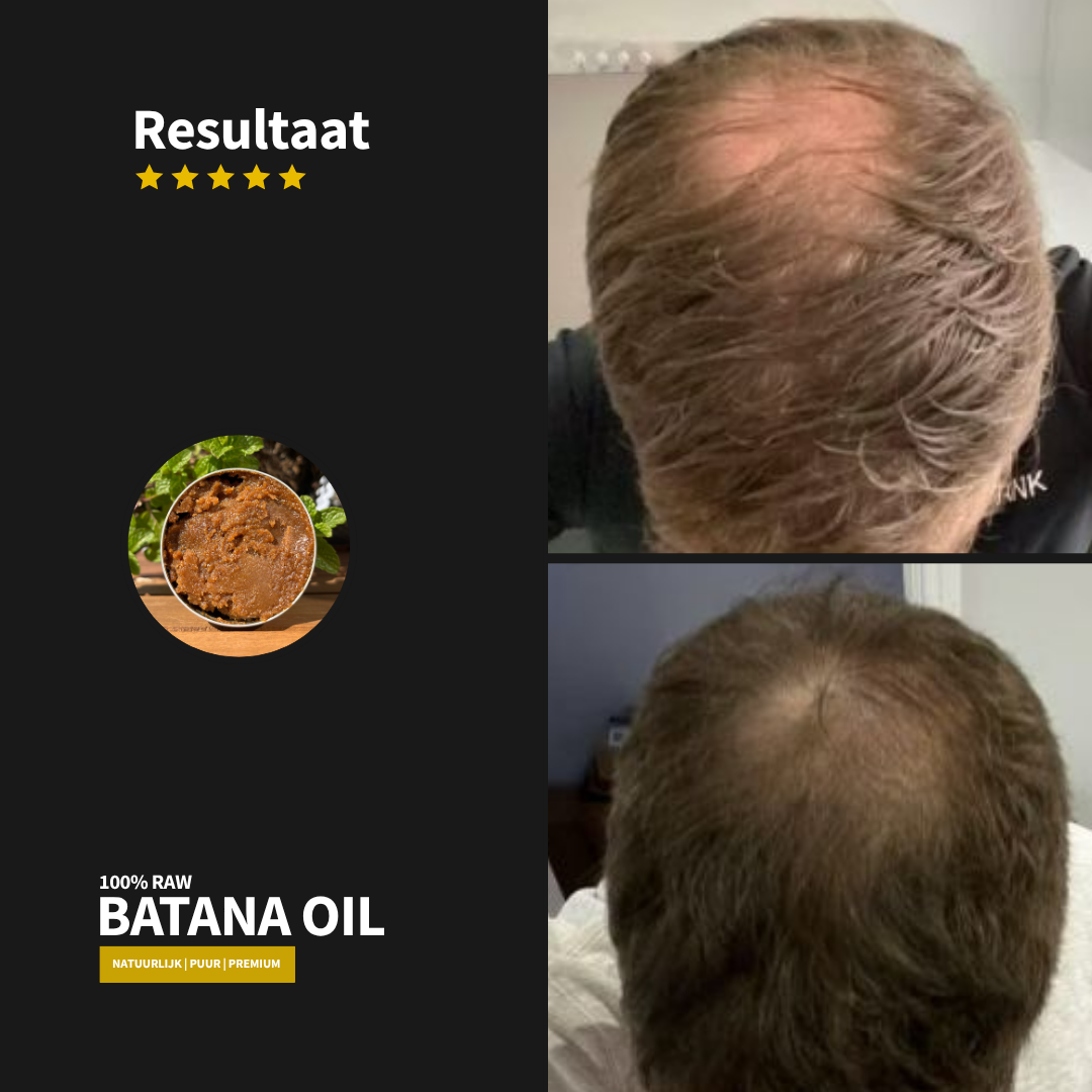 Rauwe Batana Olie